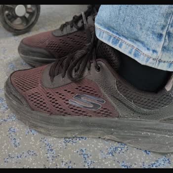 Skechers Ayakkabının Renk Solması Ve Müşteri Hizmetleri Sorunu