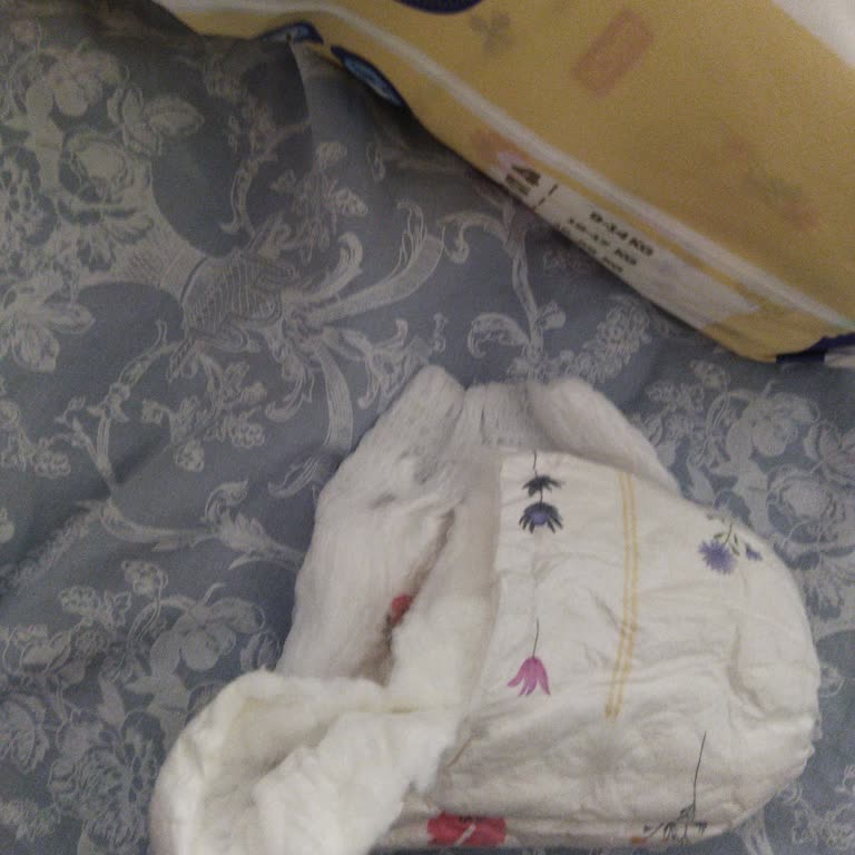 Ebebek Mağazasındaki Eksik Ve Yırtık Goon Külot Bez Sorunu