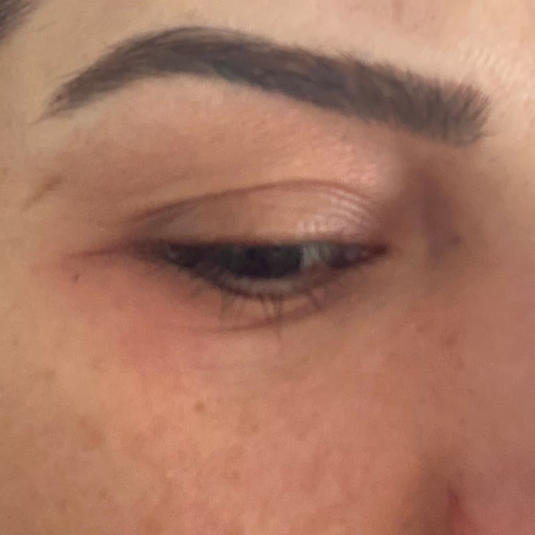 Gözaltı Kremi Alerjik Reaksiyon Ve İade Sorunu