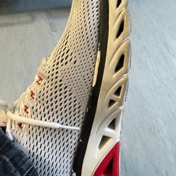 Kalitesiz Ayakkabı Ve Yetersiz Müşteri Hizmeti