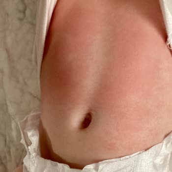 Bebekler İçin Uygun Olmayan Krem: Cilt Sorunları Ve Hayal Kırıklığı