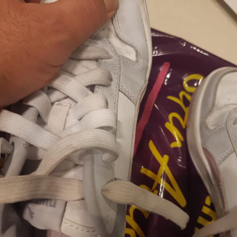 Deichmann'dan Aldığım Ayakkabının Kenarları Açıldı Ve Kimse İlgilenmiyor!