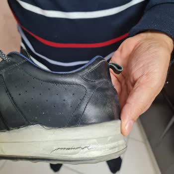 Tergan Ayakkabılarında Topuk Problemi Ve Müşteri Hizmetleri İlgisizliği