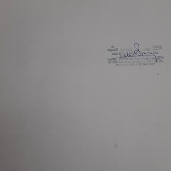 Asil Ev Aletleri Hasarlı Ürün Ve İade Sürecinde Mağduriyet