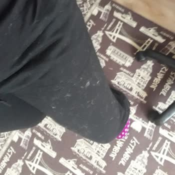 Battaniyelerde Aşırı Tüylenme Ve İade Sorunu