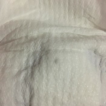 Bebek Bezinde Güven Sarsan Siyah Nokta Sorunu