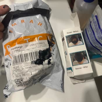 Kusurlu Ürün Ve Yetersiz Müşteri Hizmeti