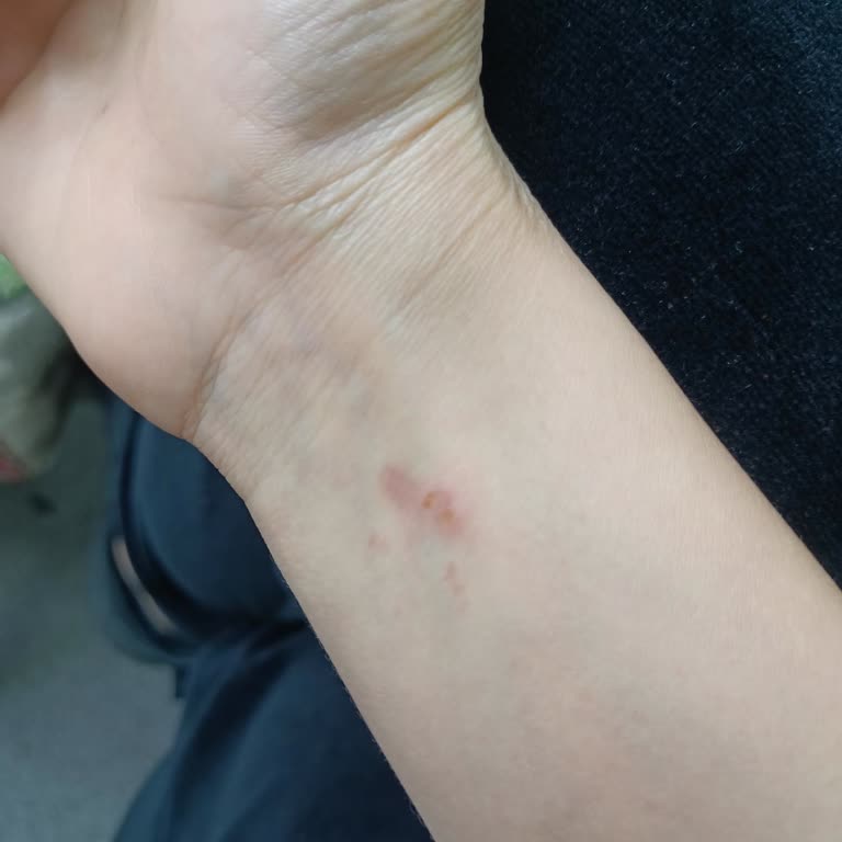 Kastel Güvenlik Sorunları Ve Kötü Deneyim