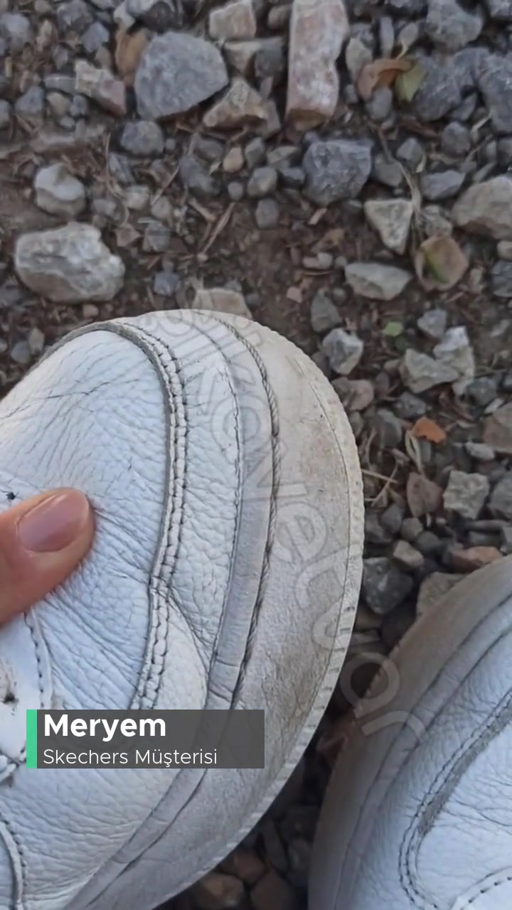 Skechers Marka Ayakkabının Derisindeki Çabuk Yıpranmalar! videonun kapak resmi