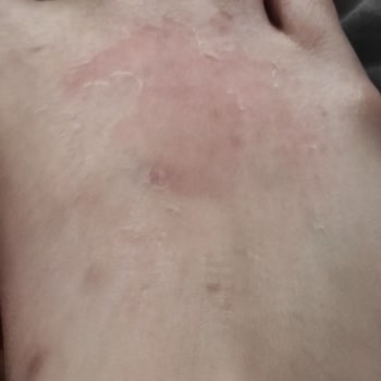 Gratis'ten Aldığım Ayak Maskesi Cildimi Tahriş Etti