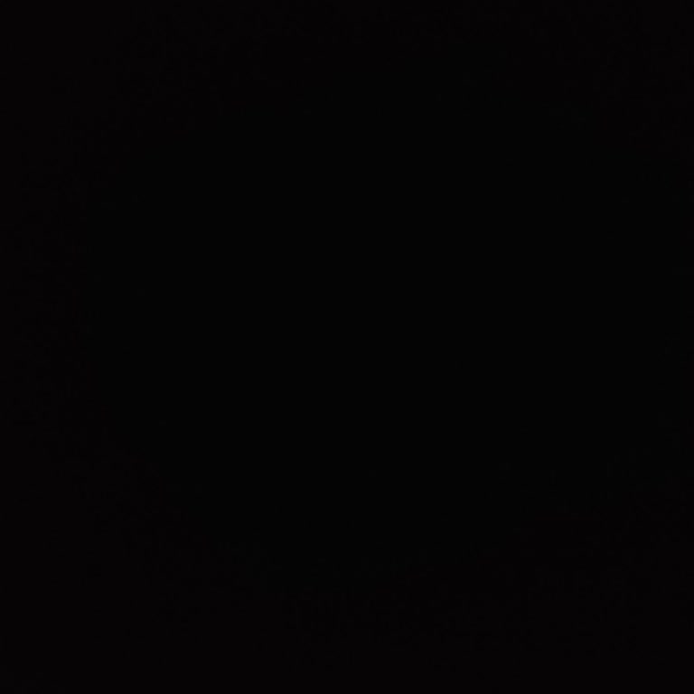 Aracımın Amortisör Sorunu Ve Reno Hizmetinden Memnuniyetsizlik