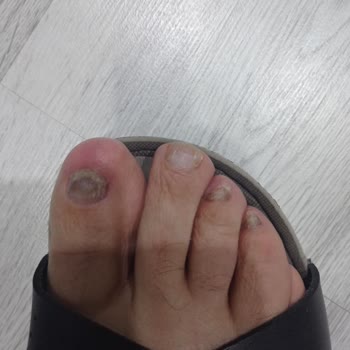 Yanıltıcı Ürün Ve İletişim Eksikliği