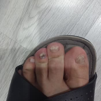 Yanıltıcı Ürün Ve İletişim Eksikliği