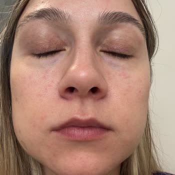 Missha Güneş Kremi İade Sorunu