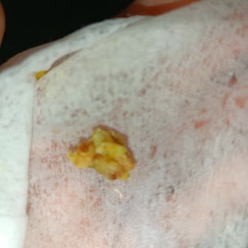 Tatlıda Sert Cisim Ve İlgisiz Hizmet