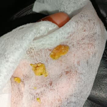 Tatlıda Sert Cisim Ve İlgisiz Hizmet