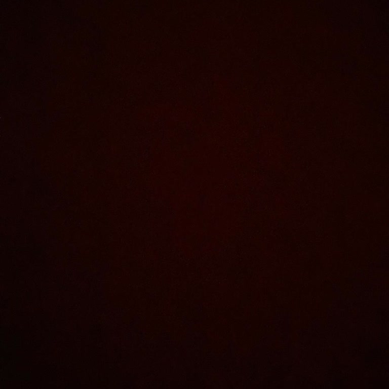 Botox Sonrası Hayal Kırıklığı Ve Zaman Kaybı