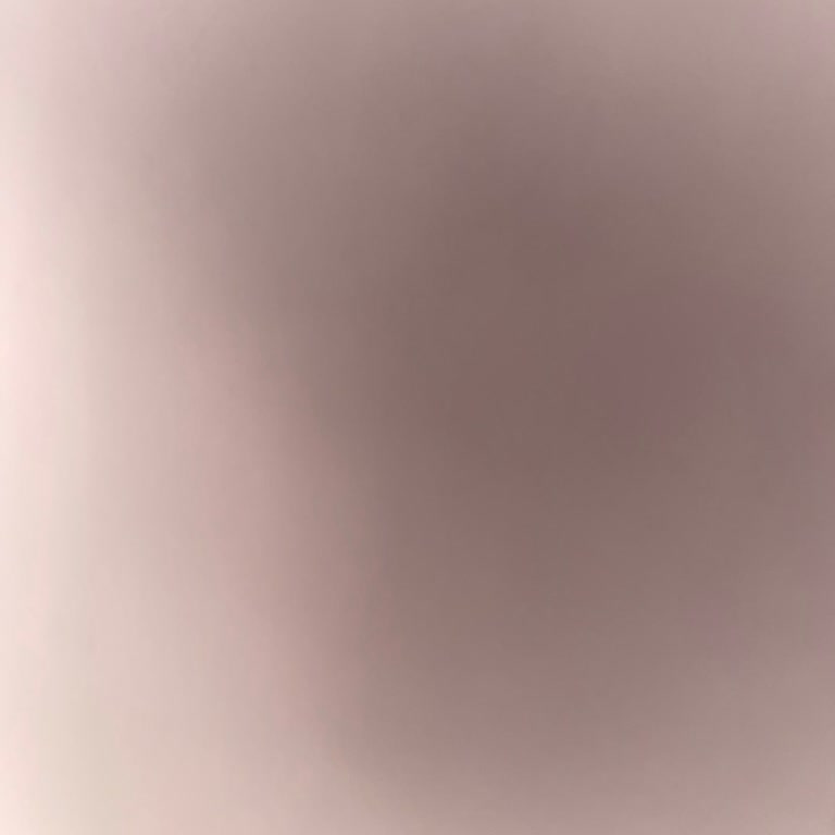 Yetkili Servis İhmali: Gaz Kaçağı Tehlikesi