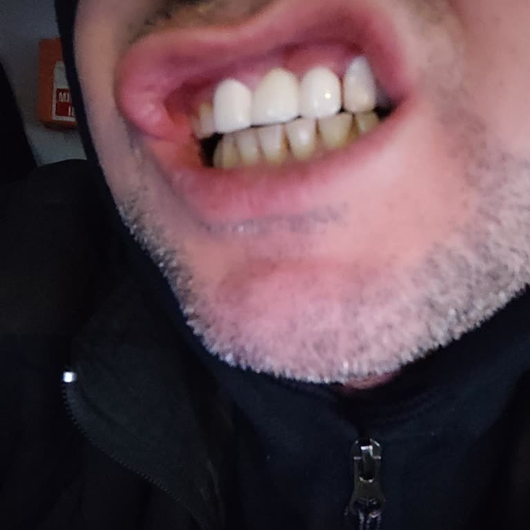 DT. İsmail Karamehmet Şikayeti