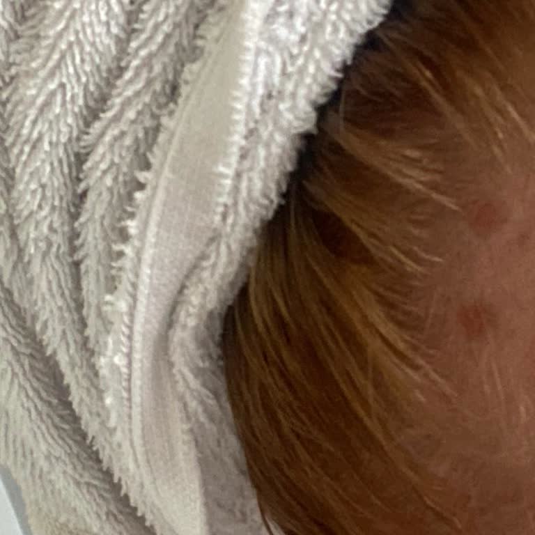 Saç Boyası Yanması: İlk Kez Yaşadığım Bir Sorun