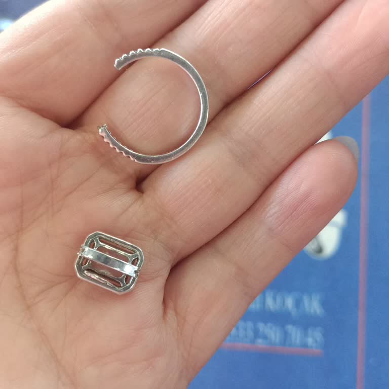 Yüzüğün Saman Dolu Çıkması Ve Kötü Hizmet