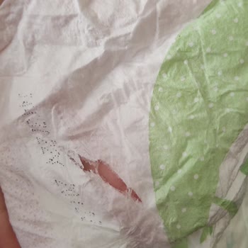 Defolu Bebek Bezleriyle Hayal Kırıklığı