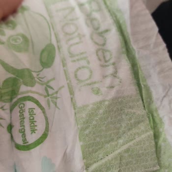 Defolu Bebek Bezleriyle Hayal Kırıklığı