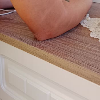 Özlem Yüksekdağ Beauty House Hatalı Lazer İşlemi Ve Kötü Hizmet Deneyimi