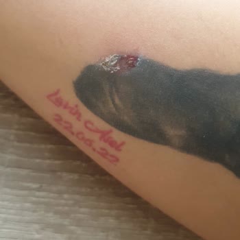 Özlem Yüksekdağ Beauty House Hatalı Lazer İşlemi Ve Kötü Hizmet Deneyimi