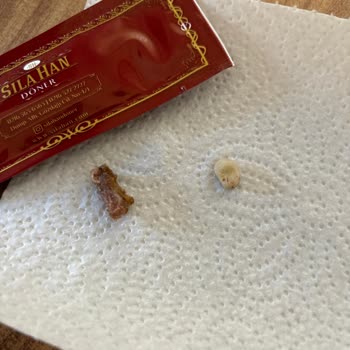 Sıla Han Döner Kebap Şikayeti