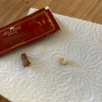 Sıla Han Döner Kebap Şikayeti