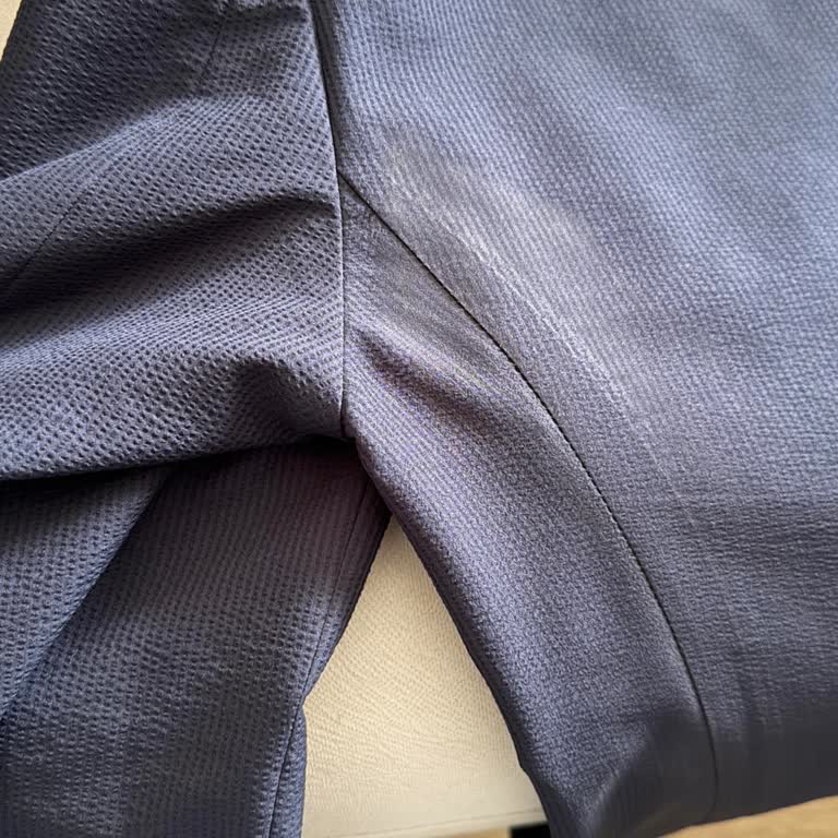 Network Mağazasında Tadilat Sonrası Ütü Yanığı Şoku