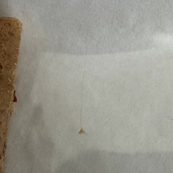 Protein Barında Yabancı Cisim Bulundu