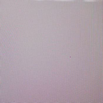 TCL TV'de Ölü Piksel Ve Gölgelenme Sorunu