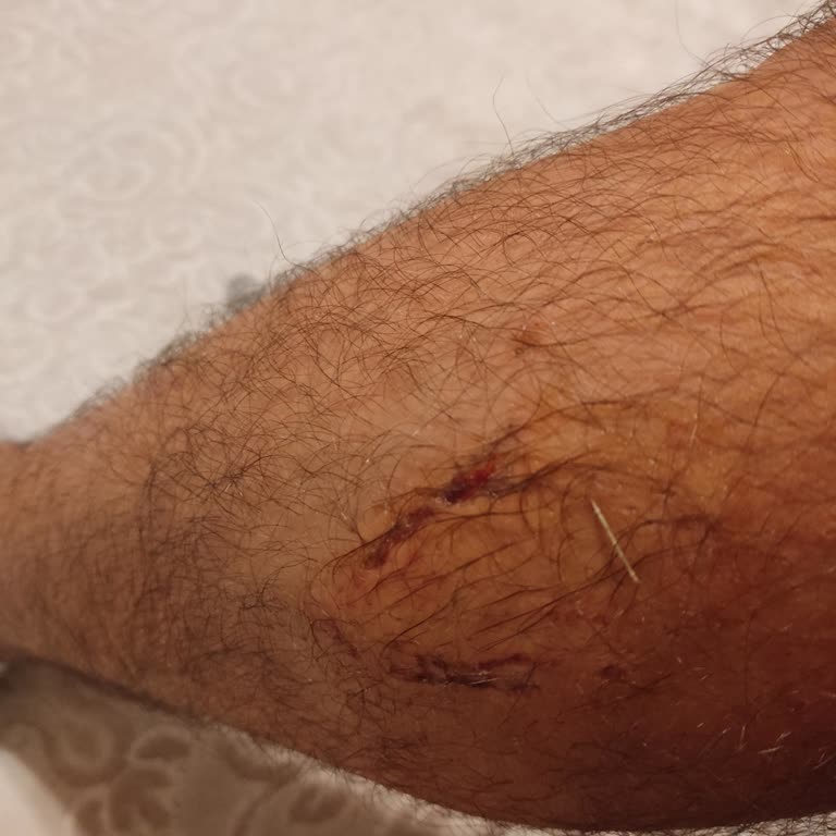 Rekreasyon Alanında Köpek Saldırısı Tehlikesi