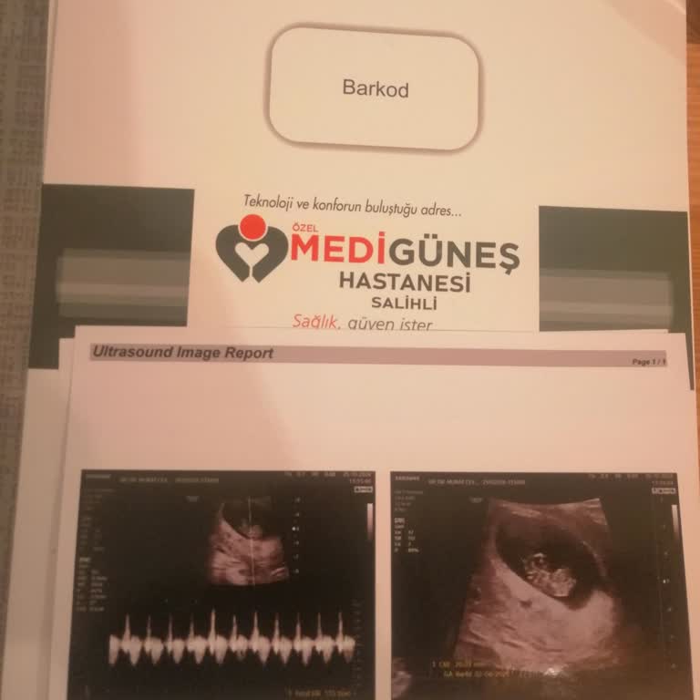 Özel Medigüneş Hastanesi Yanlış Kürtaj Kararı!