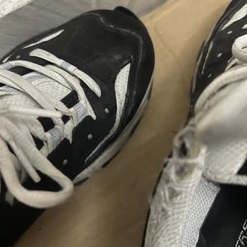 Skechers Ayakkabıda Kalite Problemi Ve Yetersiz Müşteri Hizmeti