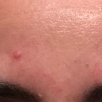 Neutrogena Güvendiğim Markanın Ürünü Cildimde Tahrişe Sebep Oldu