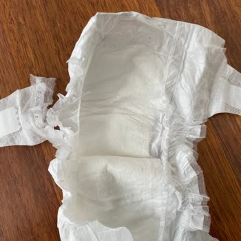 Bebek Bezlerinde Sürekli Kopan Lastikler Ve Hayal Kırıklığı