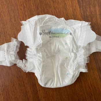 Bebek Bezlerinde Sürekli Kopan Lastikler Ve Hayal Kırıklığı
