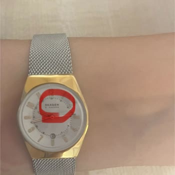 Defolu Ürün Şoku: Skagen Saat Hayal Kırıklığı