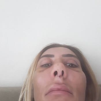 Estetik Ameliyatı Kabusu: H***** A**** Mağduriyeti
