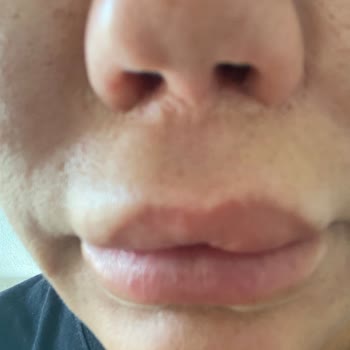 Estetik Ameliyatı Kabusu: H***** A**** Mağduriyeti