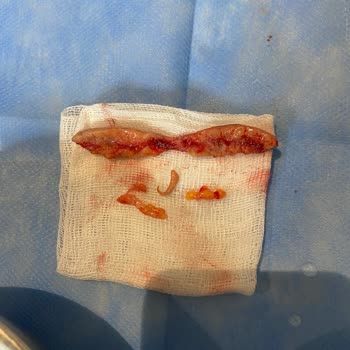 Estetik Ameliyatı Kabusu: H***** A**** Mağduriyeti