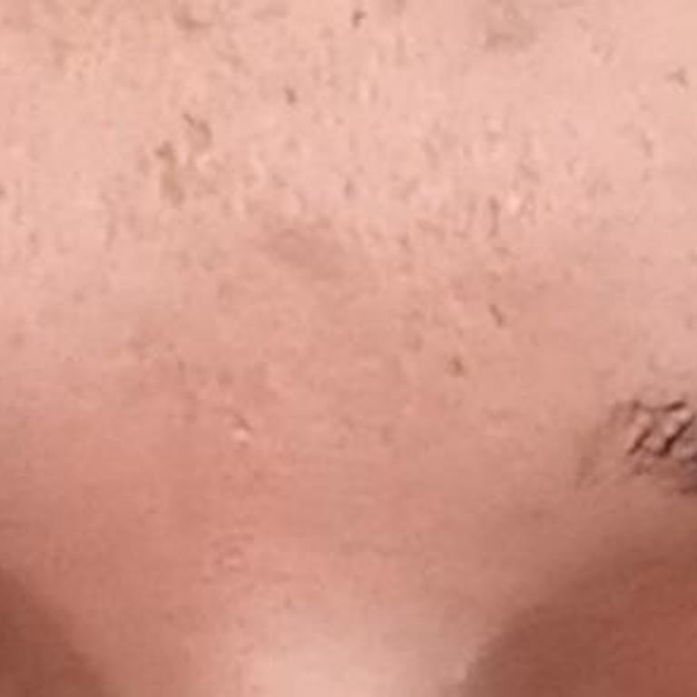 Tuğçe Çolak Beauty İşlem İçin Benden Fazla Para Aldılar!