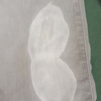 Pantolon Lekesi Ve Renk Açılması Sorunu
