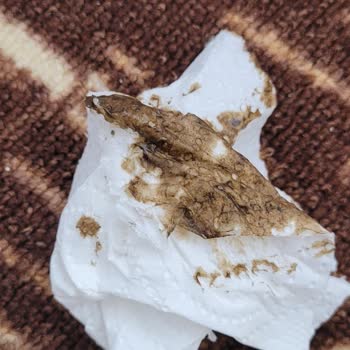 Paslanan Blender Çorba Ezici: Çocuklarımın Sağlığı Tehlikede!