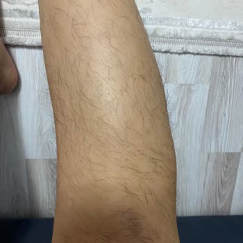 Rose Life Güzellik Merkezi Sultanbeyli Şikayeti