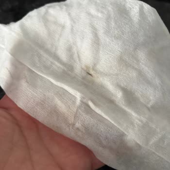Digiturk Yanlış Paket Ve Kötü Hizmet Deneyimi