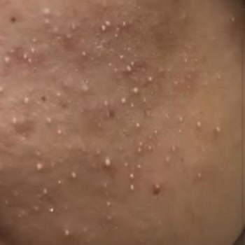 Son Kullanma Tarihi Geçmiş Ürün Mağduriyeti